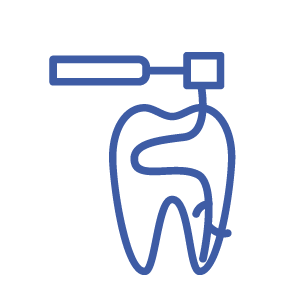 Endodoncia